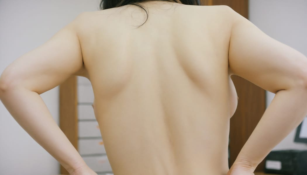 Tags: 21872187, SDXL
{"3": {"inputs": {"seed": 253625435299983, "steps": 32, "cfg": 5.02, "sampler_name": "dpmpp_2m", "scheduler": "karras", "denoise": 1.0, "model": ["27", 0], "positive": ["6", 0], "negative": ["7", 0], "latent_image": ["5", 0]}, "class_type": "KSampler"}, "4": {"inputs": {"ckpt_name": "helloworldxl.safetensors"}, "class_type": "CheckpointLoaderSimple"}, "5": {"inputs": {"width": 1344, "height": 768, "batch_size": 1}, "class_type": "EmptyLatentImage"}, "6": {"inputs": {"text": "25 year old girl, (japanese:1.09), (korean:1.10), (seductive facial expression:1.08), (seductive pose:1.08), (double eyelids:0.95), (sexy lips:1.11), (cute:0.97), (beautiful eyes:1.11), (temptress:0.95), (idol:1.14), (blush:0.98), (detailed face:1.00), (slim:1.09), (eyelashes:0.97), (on all fours:1.11), (spreading ass cheeks:0.97), (from behind:1.03), (backboob:1.12), (an office lady:1.13), (film:1.00), (natural looking skin:1.07), (detailed skin:1.07), (RAW:1.01), (soft lighting:1.03), (portra:1.07), (textured skin:1.02), (candid cinema:1.02), (skin fuzz:1.03)", "clip": ["27", 1]}, "class_type": "CLIPTextEncode"}, "7": {"inputs": {"text": "(worst quality:1.09), (low resolution:1.06), (watermark:1.09), (twisted:1.09), (distorted:1.06), (open mouth:1.07), (bad hands:1.08)", "clip": ["27", 1]}, "class_type": "CLIPTextEncode"}, "8": {"inputs": {"samples": ["3", 0], "vae": ["4", 2]}, "class_type": "VAEDecode"}, "25": {"inputs": {"lora_name": "nudify_xl.safetensors", "strength_model": 0.11, "strength_clip": 0.29, "model": ["4", 0], "clip": ["4", 1]}, "class_type": "LoraLoader"}, "26": {"inputs": {"lora_name": "shirtlift_SDXL_v2.safetensors", "strength_model": 0.11, "strength_clip": 0.01, "model": ["25", 0], "clip": ["25", 1]}, "class_type": "LoraLoader"}, "27": {"inputs": {"lora_name": "PerfectEyesXL.safetensors", "strength_model": 0.0, "strength_clip": 0.17, "model": ["26", 0], "clip": ["26", 1]}, "class_type": "LoraLoader"}, "30": {"inputs": {"model_name": "4x_NMKD-Superscale-SP_178000_G.pth"}, "class_type": "UpscaleModelLoader"}, "31": {"inputs": {"upscale_model": ["30", 0], "image": ["8", 0]}, "class_type": "ImageUpscaleWithModel"}, "32": {"inputs": {"upscale_method": "lanczos", "scale_by": 0.5, "image": ["31", 0]}, "class_type": "ImageScaleBy"}, "33": {"inputs": {"pixels": ["32", 0], "vae": ["4", 2]}, "class_type": "VAEEncode"}, "34": {"inputs": {"seed": 253625435299983, "steps": 32, "cfg": 5.02, "sampler_name": "dpmpp_2m", "scheduler": "karras", "denoise": 0.3, "model": ["27", 0], "positive": ["6", 0], "negative": ["7", 0], "latent_image": ["33", 0]}, "class_type": "KSampler"}, "36": {"inputs": {"samples": ["34", 0], "vae": ["4", 2]}, "class_type": "VAEDecode"}, "39": {"inputs": {"filename_prefix": "comfyapi-1726746989262", "images": ["36", 0]}, "class_type": "SaveImage"}}